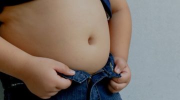 obesità infantile